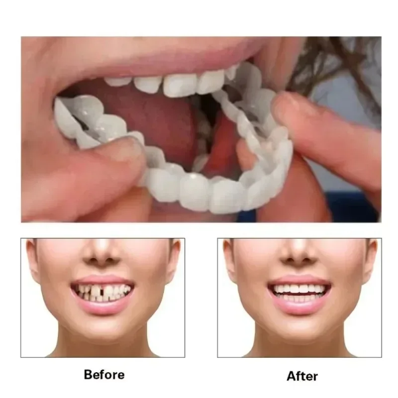 Fake Tooth Cover Perfect Fit T - Beauty Makeup News recensione e prezzo